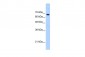 FBXW7 Antibody - C-terminal region